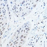 Immunohistochemistry - Anti-Ubiquitin Antibody (A307667) - Antibodies.com