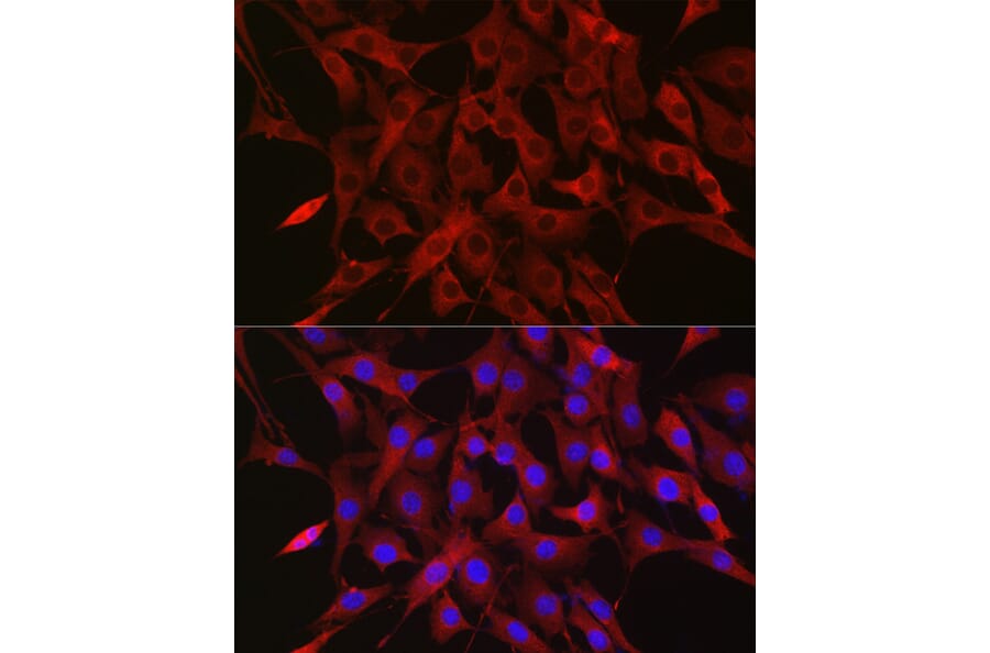Immunofluorescence - Anti-Ubiquitin Antibody (A307667) - Antibodies.com