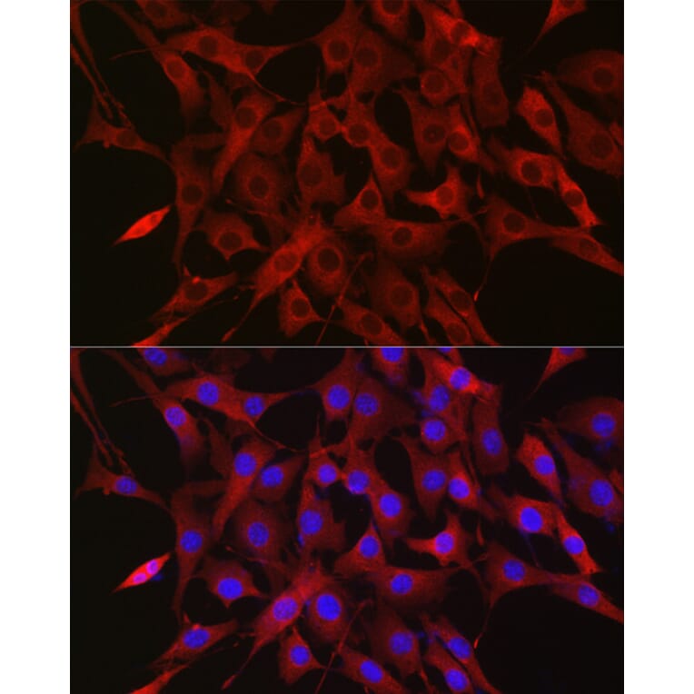 Immunofluorescence - Anti-Ubiquitin Antibody (A307667) - Antibodies.com