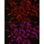 Immunofluorescence - Anti-Ubiquitin Antibody (A307667) - Antibodies.com