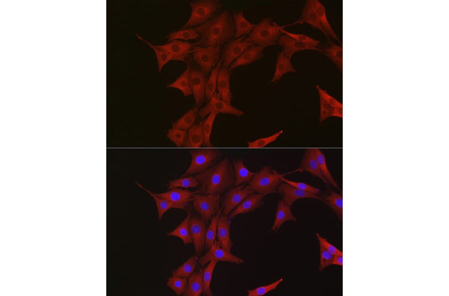 Immunofluorescence - Anti-Ubiquitin Antibody (A307667) - Antibodies.com