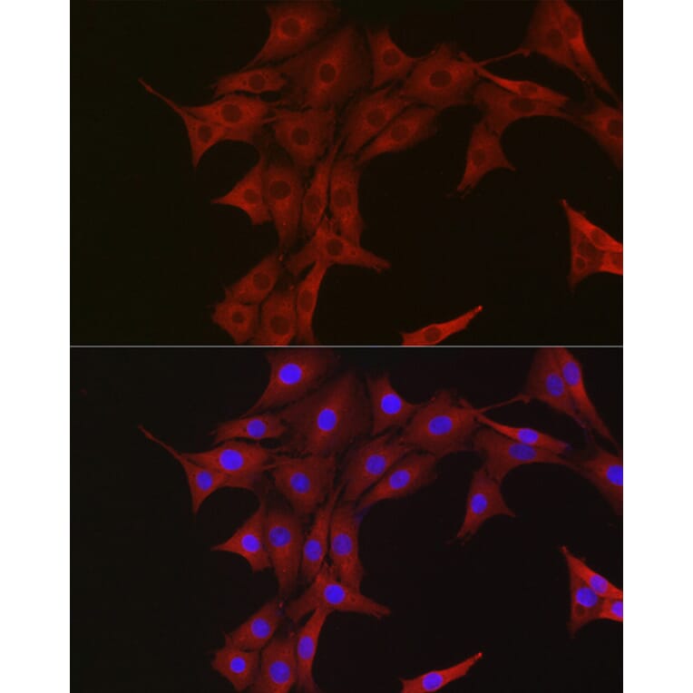 Immunofluorescence - Anti-Ubiquitin Antibody (A307667) - Antibodies.com