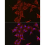 Immunofluorescence - Anti-Ubiquitin Antibody (A307667) - Antibodies.com