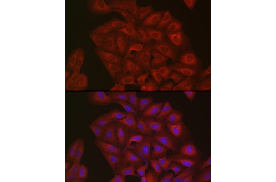 Immunofluorescence - Anti-Ubiquitin Antibody (A307667) - Antibodies.com