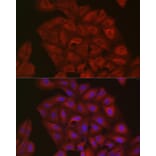 Immunofluorescence - Anti-Ubiquitin Antibody (A307667) - Antibodies.com