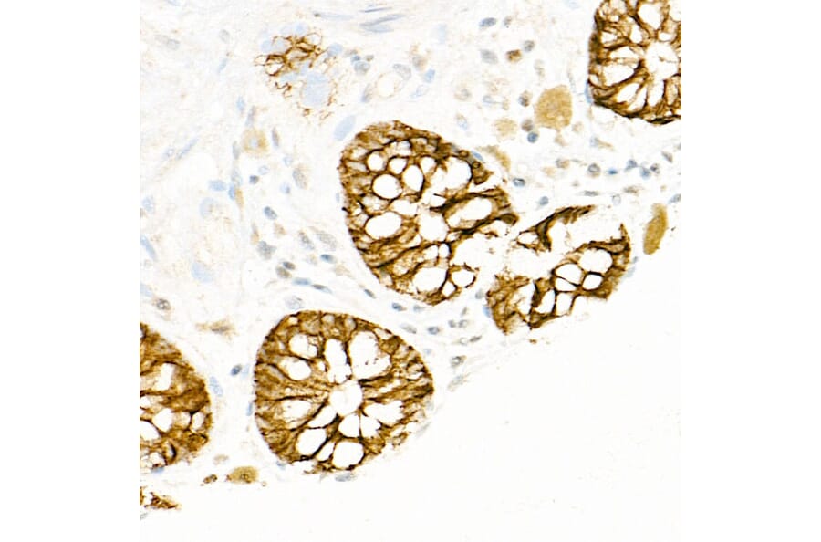 Immunohistochemistry - Anti-FXYD3 Antibody (A307668) - Antibodies.com