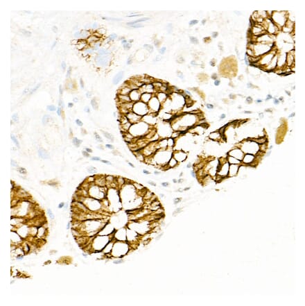 Immunohistochemistry - Anti-FXYD3 Antibody (A307668) - Antibodies.com