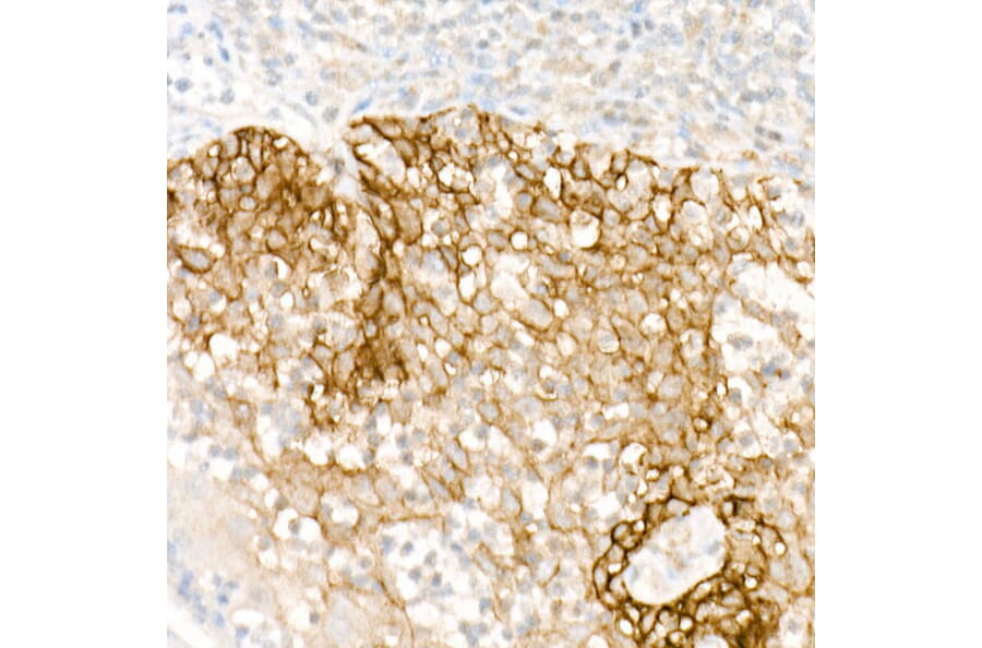 Immunohistochemistry - Anti-FXYD3 Antibody (A307668) - Antibodies.com
