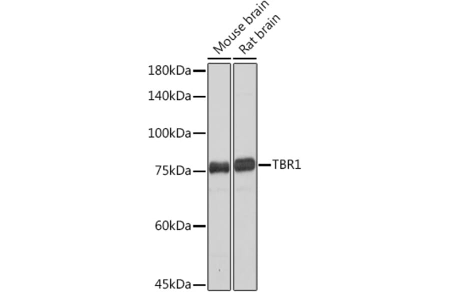 Western Blot - Anti-TBR1 Antibody [ARC2198] (A307669) - Antibodies.com