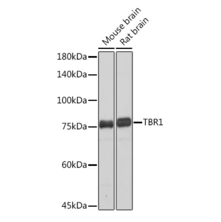 Western Blot - Anti-TBR1 Antibody [ARC2198] (A307669) - Antibodies.com