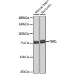 Western Blot - Anti-TBR1 Antibody [ARC2198] (A307669) - Antibodies.com