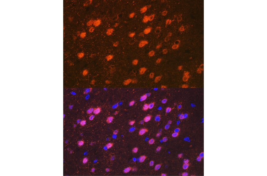 Immunofluorescence - Anti-TBR1 Antibody [ARC2198] (A307669) - Antibodies.com