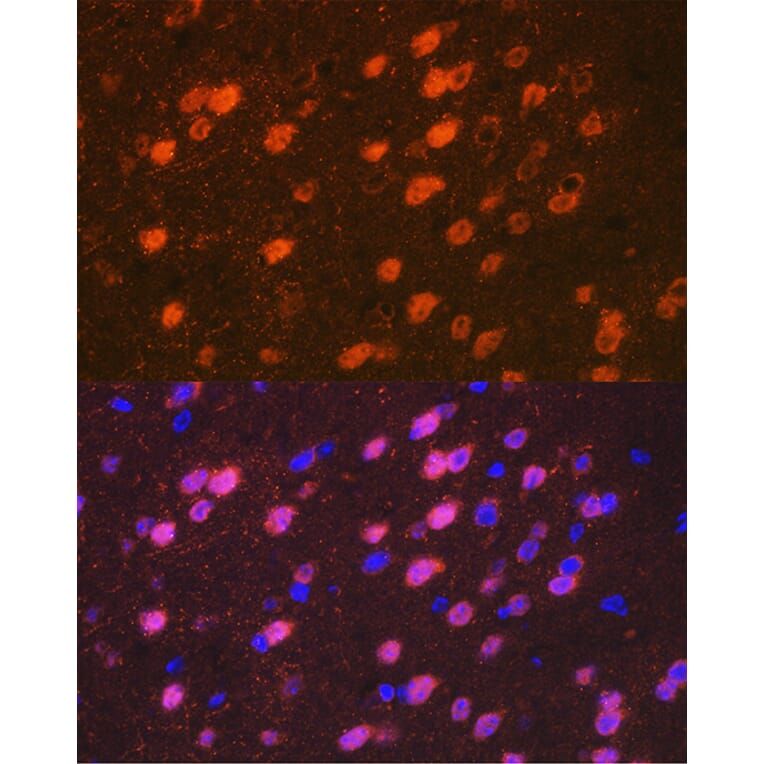 Immunofluorescence - Anti-TBR1 Antibody [ARC2198] (A307669) - Antibodies.com