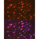 Immunofluorescence - Anti-TBR1 Antibody [ARC2198] (A307669) - Antibodies.com