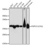 Western Blot - Anti-PGP9.5 Antibody [ARC50367] (A307670) - Antibodies.com