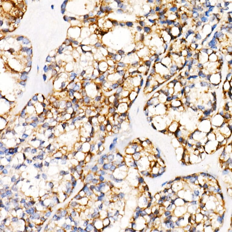 Immunohistochemistry - Anti-PGP9.5 Antibody [ARC50367] (A307670) - Antibodies.com