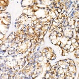 Immunohistochemistry - Anti-PGP9.5 Antibody [ARC50367] (A307670) - Antibodies.com