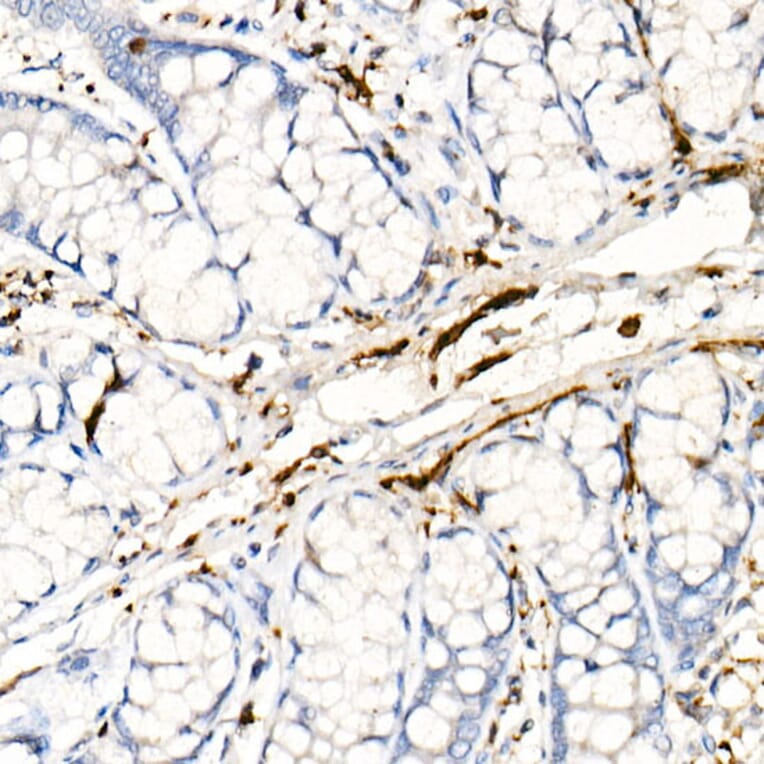 Immunohistochemistry - Anti-PGP9.5 Antibody [ARC50367] (A307670) - Antibodies.com