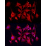 Immunofluorescence - Anti-PGP9.5 Antibody [ARC50367] (A307670) - Antibodies.com