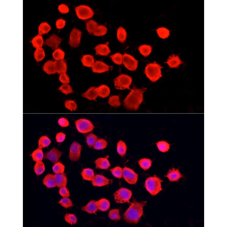 Immunofluorescence - Anti-PGP9.5 Antibody [ARC50367] (A307670) - Antibodies.com