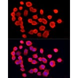 Immunofluorescence - Anti-PGP9.5 Antibody [ARC50367] (A307670) - Antibodies.com