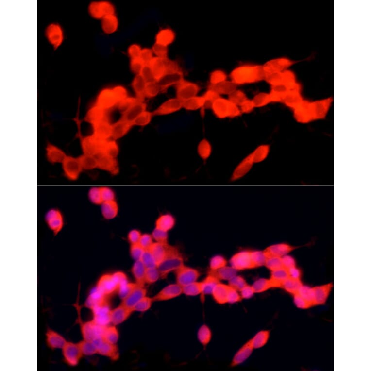 Immunofluorescence - Anti-PGP9.5 Antibody [ARC50367] (A307670) - Antibodies.com