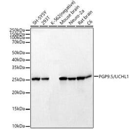 Western Blot - Anti-PGP9.5 Antibody [ARC50379] (A307671) - Antibodies.com