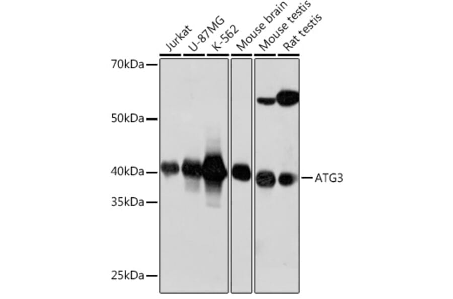 Western Blot - Anti-ATG3 Antibody [ARC0073] (A307672) - Antibodies.com