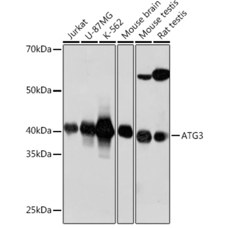 Western Blot - Anti-ATG3 Antibody [ARC0073] (A307672) - Antibodies.com