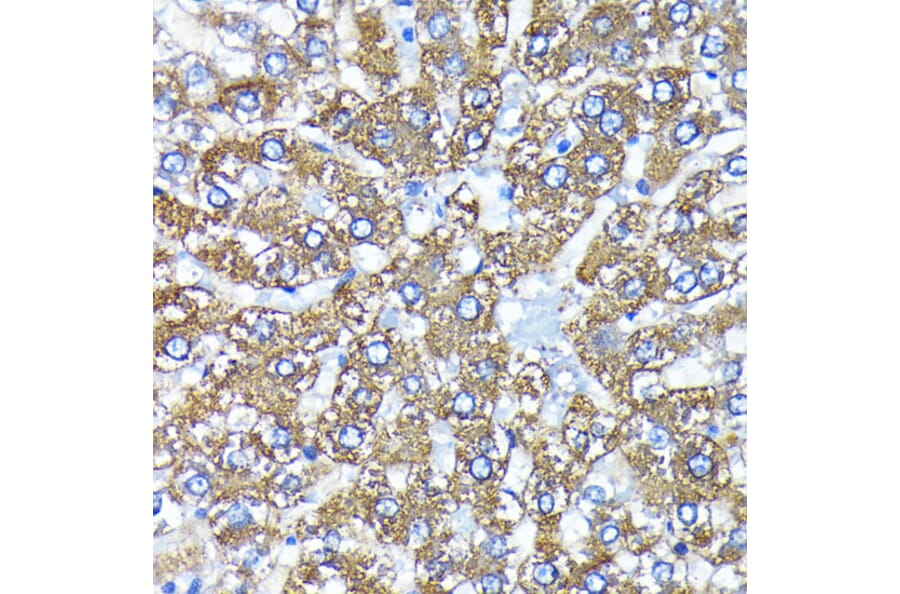 Immunohistochemistry - Anti-ATG3 Antibody [ARC0073] (A307672) - Antibodies.com