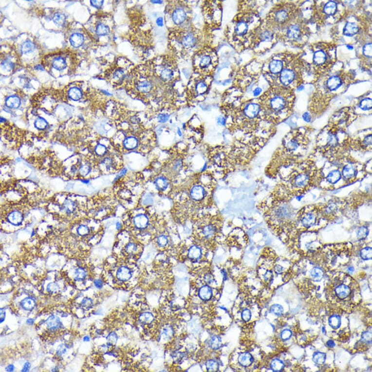 Immunohistochemistry - Anti-ATG3 Antibody [ARC0073] (A307672) - Antibodies.com