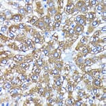 Immunohistochemistry - Anti-ATG3 Antibody [ARC0073] (A307672) - Antibodies.com