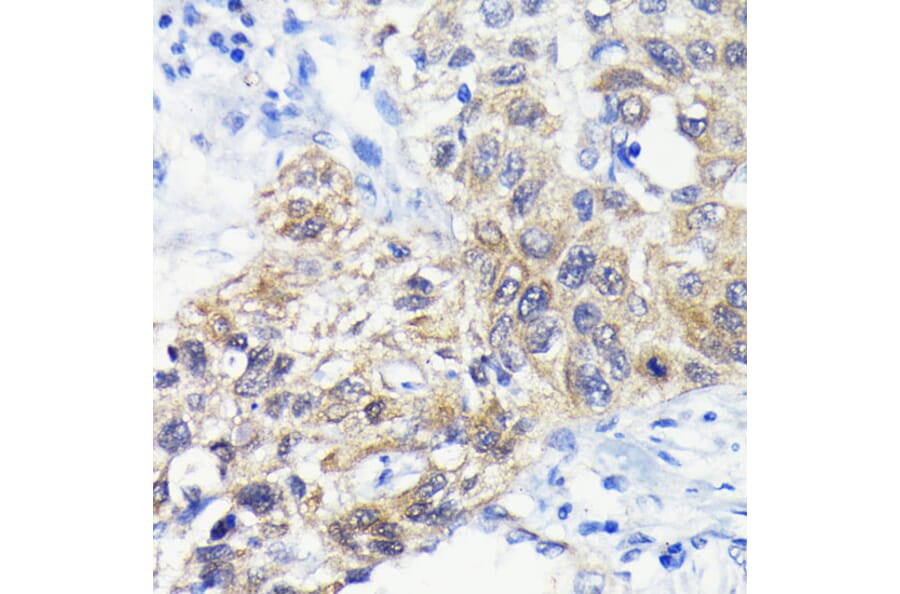Immunohistochemistry - Anti-ATG3 Antibody [ARC0073] (A307672) - Antibodies.com