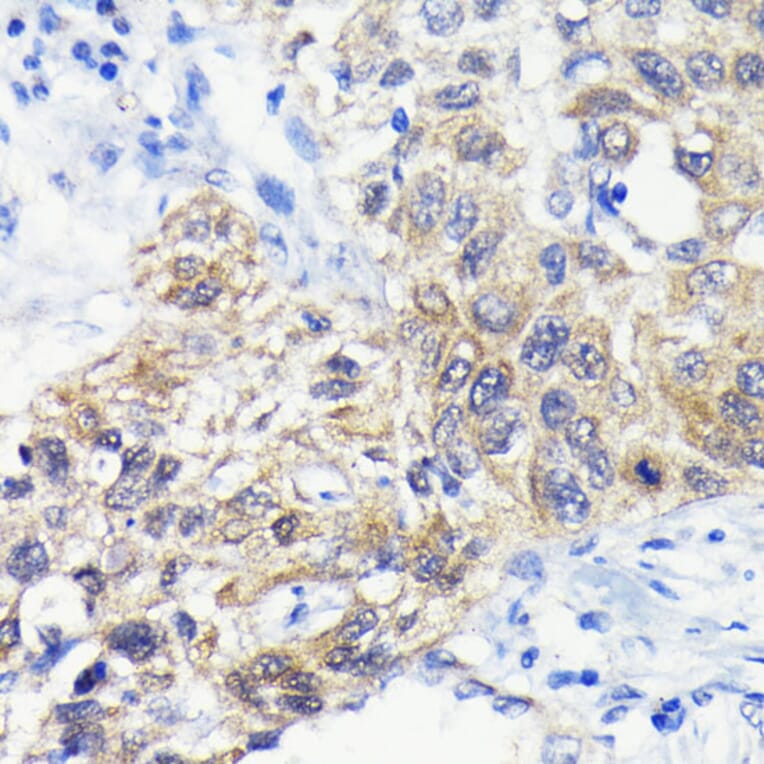 Immunohistochemistry - Anti-ATG3 Antibody [ARC0073] (A307672) - Antibodies.com