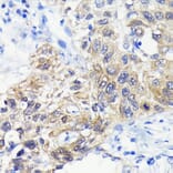 Immunohistochemistry - Anti-ATG3 Antibody [ARC0073] (A307672) - Antibodies.com