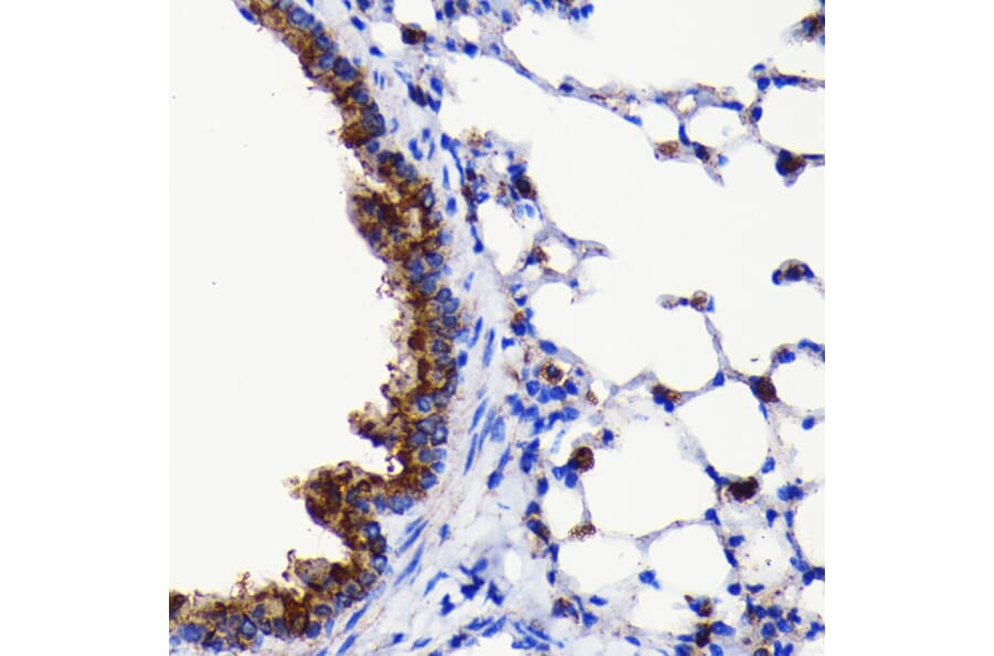 Immunohistochemistry - Anti-ATG3 Antibody [ARC0073] (A307672) - Antibodies.com