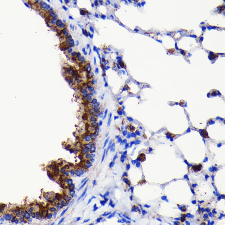 Immunohistochemistry - Anti-ATG3 Antibody [ARC0073] (A307672) - Antibodies.com