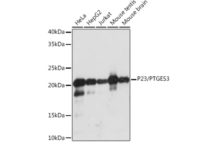 Western Blot - Anti-p23 Antibody [ARC1986] (A307673) - Antibodies.com