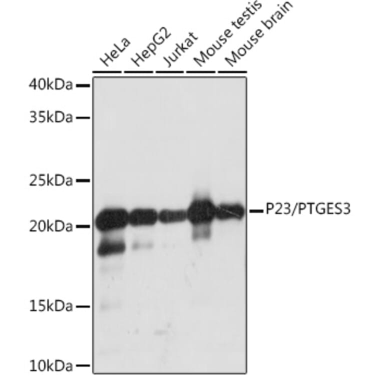 Western Blot - Anti-p23 Antibody [ARC1986] (A307673) - Antibodies.com