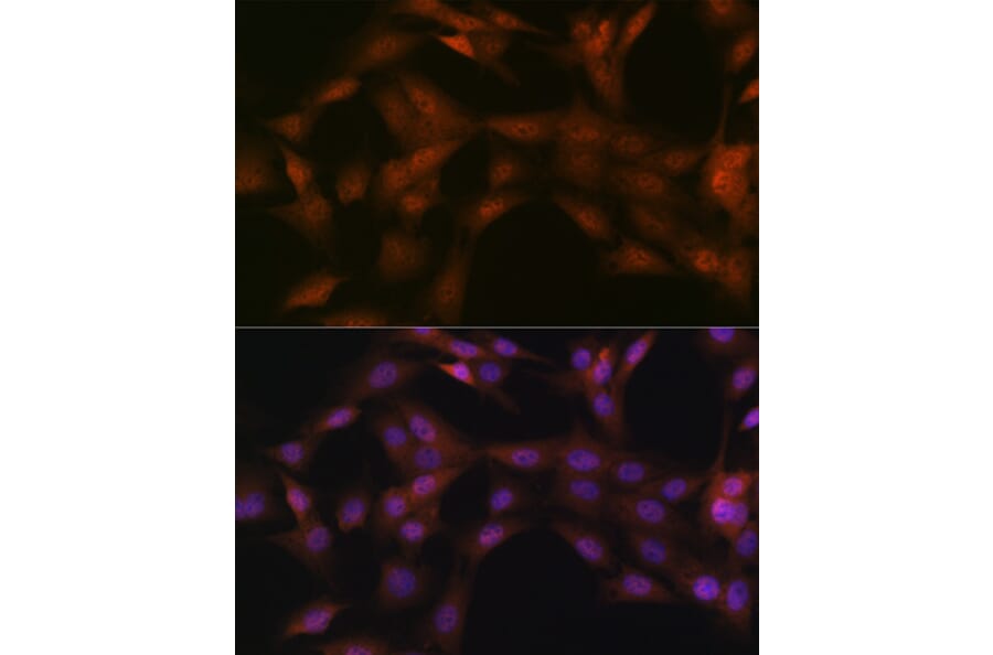 Immunofluorescence - Anti-p23 Antibody [ARC1986] (A307673) - Antibodies.com