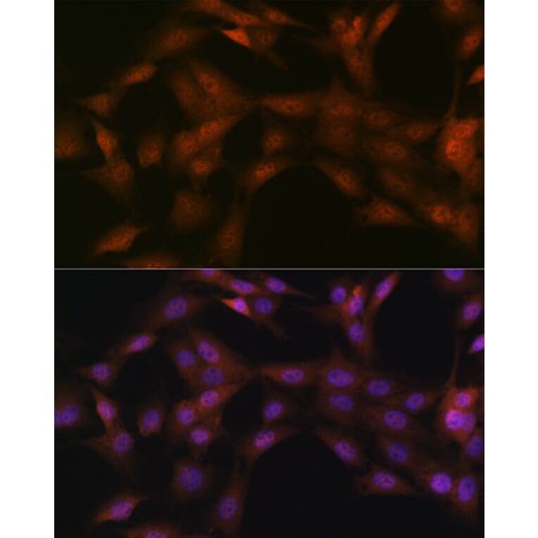 Immunofluorescence - Anti-p23 Antibody [ARC1986] (A307673) - Antibodies.com