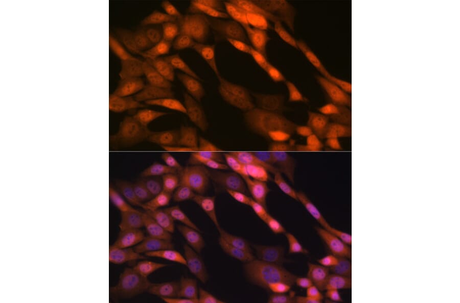 Immunofluorescence - Anti-p23 Antibody [ARC1986] (A307673) - Antibodies.com