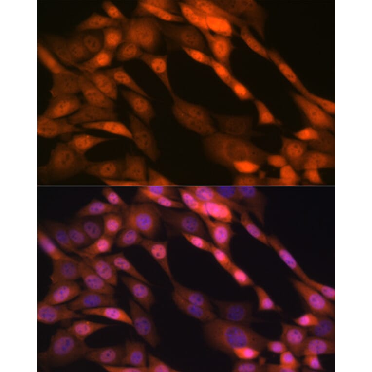 Immunofluorescence - Anti-p23 Antibody [ARC1986] (A307673) - Antibodies.com