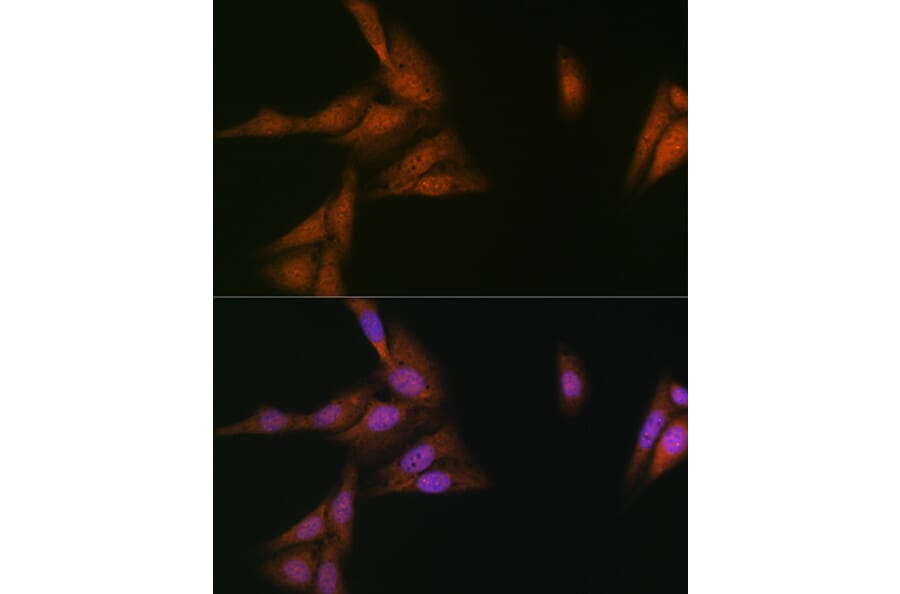 Immunofluorescence - Anti-p23 Antibody [ARC1986] (A307673) - Antibodies.com