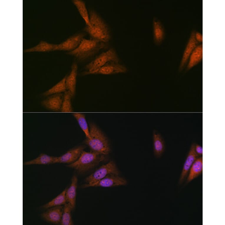 Immunofluorescence - Anti-p23 Antibody [ARC1986] (A307673) - Antibodies.com