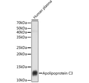 Western Blot - Anti-Apolipoprotein CIII Antibody [ARC1886] (A307674) - Antibodies.com