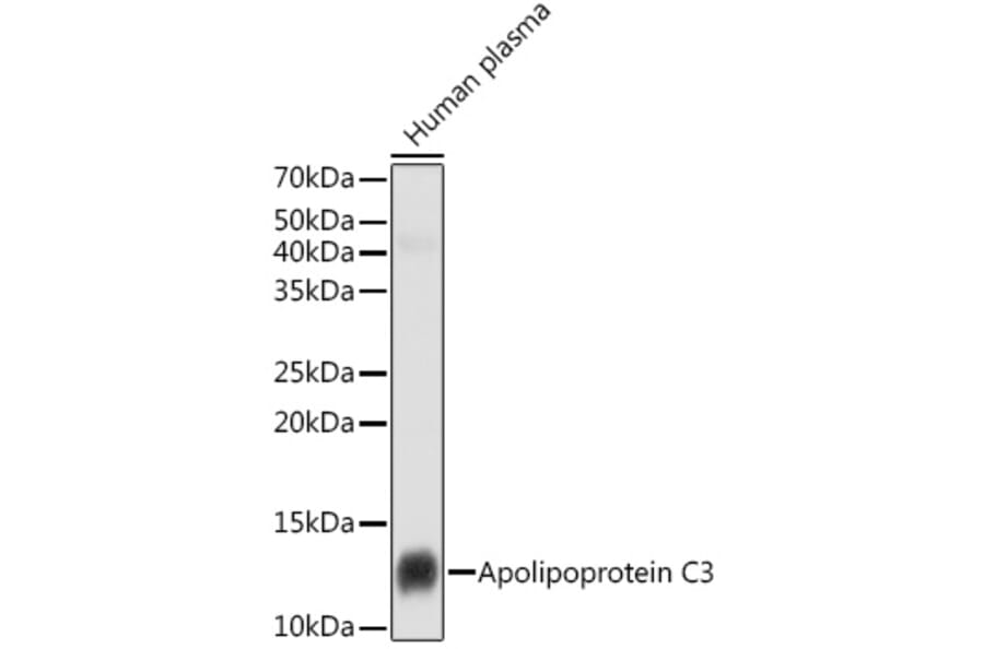 Western Blot - Anti-Apolipoprotein CIII Antibody [ARC1886] (A307674) - Antibodies.com