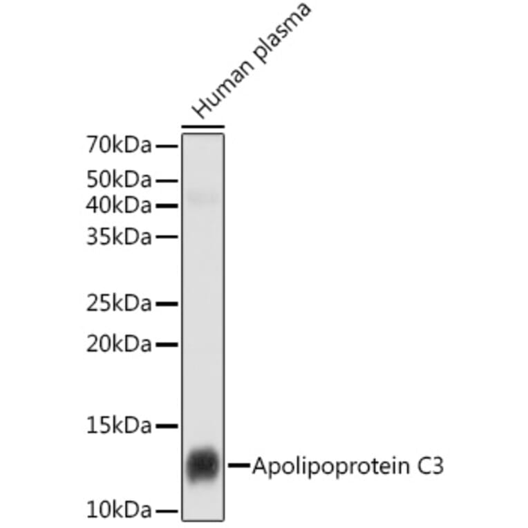Western Blot - Anti-Apolipoprotein CIII Antibody [ARC1886] (A307674) - Antibodies.com