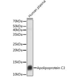 Western Blot - Anti-Apolipoprotein CIII Antibody [ARC1886] (A307674) - Antibodies.com