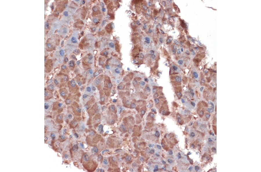 Immunohistochemistry - Anti-Apolipoprotein CIII Antibody [ARC1886] (A307674) - Antibodies.com